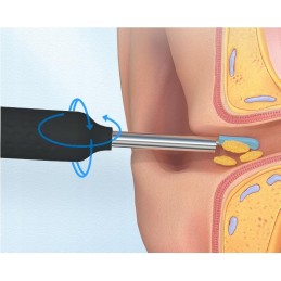 Digitaalinen Otoskooppi WiFi | HD-kamera 1080P | LED