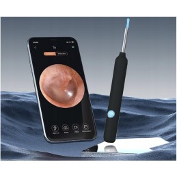 Digitaalinen Otoskooppi WiFi | HD-kamera 1080P | LED